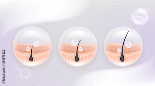 Hyaluronic acid and Niacinamide before and after hair and skin solutions ad. white collagen serum drop into skin cells with cosmetic advertising background ready to use, illustration vector.