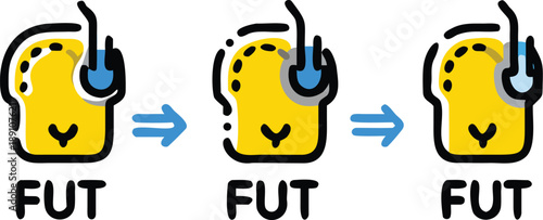 fue vs fut hair transplantation illustration