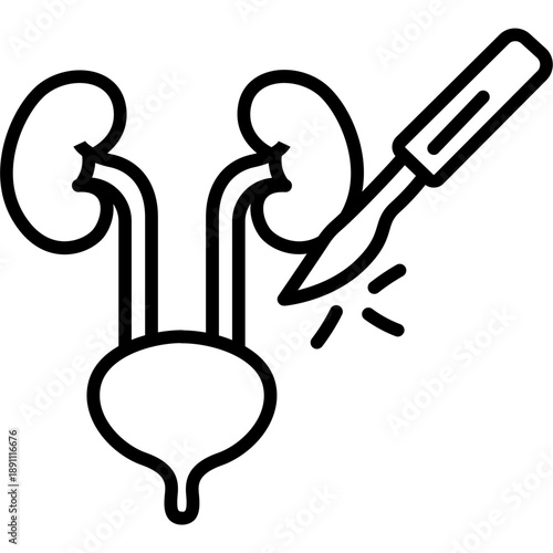 Urologic Surgery Vector Icon