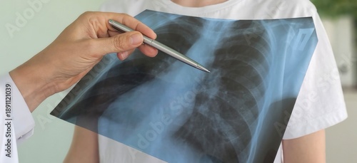 Wallpaper Mural x ray thorax,doctor looks at the picture in the hospital for pneumonia and cancer concept Torontodigital.ca