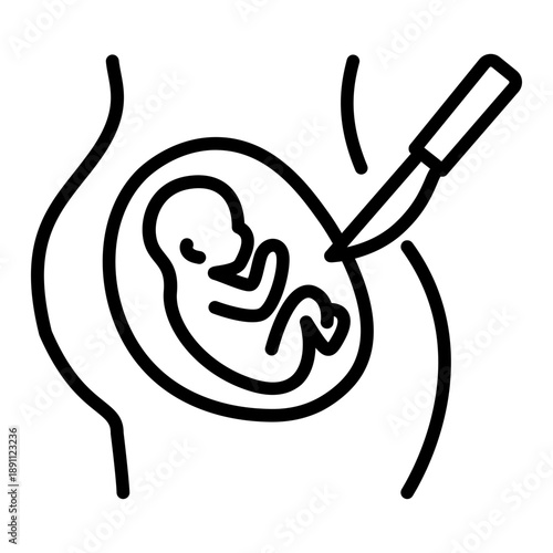 Cesarean Section Vector Icon