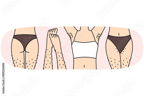 Hairy female legs and thighs in need of depilation or epilation using wax tape and sugaring. Body parts of girl in underwear, for advertising depilation services from cosmetologist