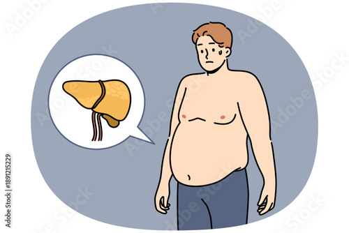 Liver illnesses in men cause obesity and digestive problems and symptoms of fatty hepatosis. Yellow liver near guy suffering from jaundice caused by poor hygiene or weakened immune system