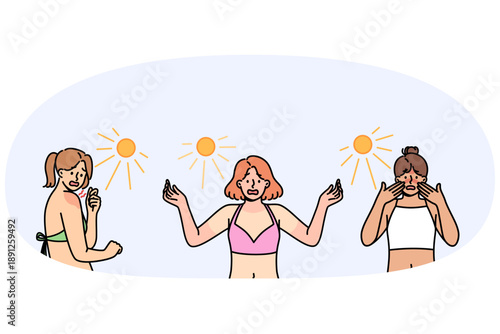 Sunburns on bodies of shocked women relaxing on beach and not using sunscreen and uv rays. Problem of sunburns or uneven tanning among girls visiting southern islands for first time
