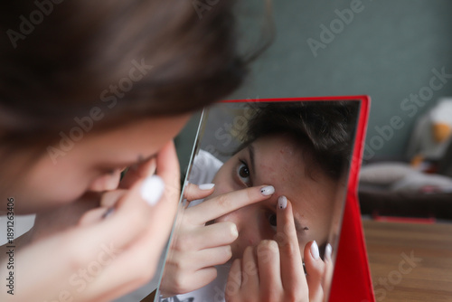 A teenage girl sits at a table in front of a mirror and squeezes pimples while doing facial skin care at home. The scene reflects the typical problems of adolescence, acne, self-esteem, hygiene, and