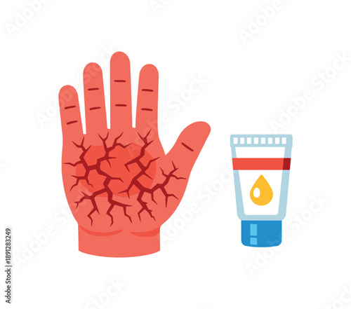 colored flat icon vector illustration isolated on white background simple hand with red cracked skin and tiny cream tube skin irritation or dermatitis