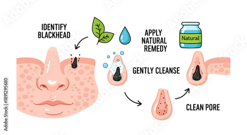 Illustrated guide on natural blackhead removal methods and pore cleansing process