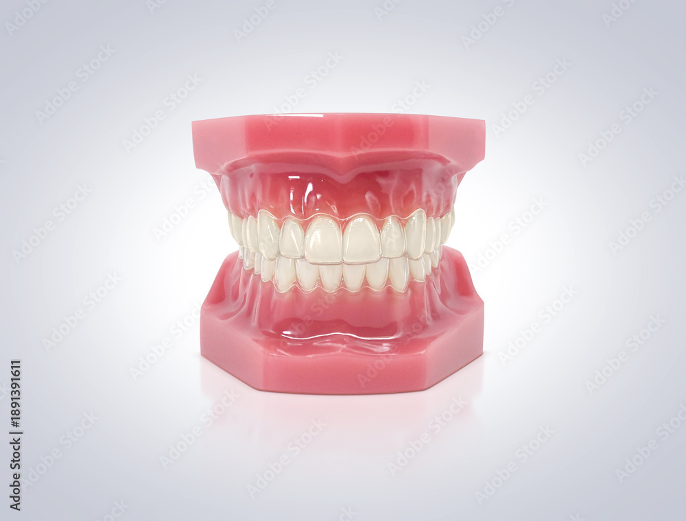 Obraz premium インビザライン マウスピース矯正 イラスト リアル