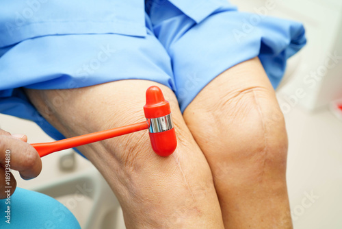 Asian doctor knock on knee reflex nerve for check and treatment senior patient in hospital.