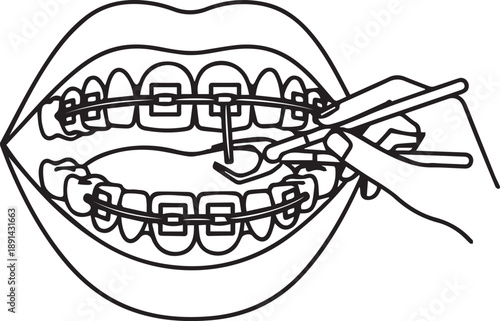 Braces cleaning vector illustration showing mouth with dental braces and hand using floss and interdental brush for proper oral hygiene maintaining healthy teeth and gums