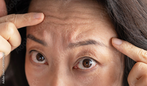 Fotografie closeup portrait of Asian middle age woman showing her skin closeup showing wrinkles in her forehead