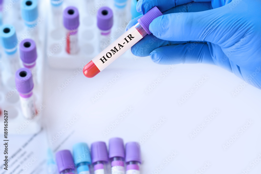 Naklejka premium Doctor Holding HOMA IR Blood Test Tube in Modern Laboratory, Insulin Resistance Analysis, Diabetes Risk Assessment, Metabolic Health Diagnostics and Medical Research Concept