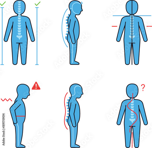 Diagrams Illustrating Human Posture and Spinal Alignment with Medical Symbols spine back