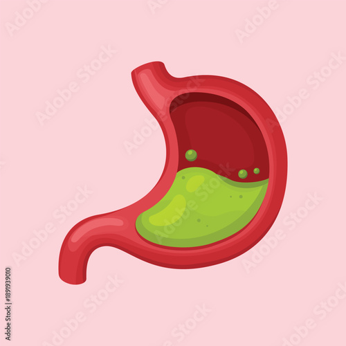 A stomach illustration depicting gastric acid inside the organ, suitable for digestive system education and health-related explanations.