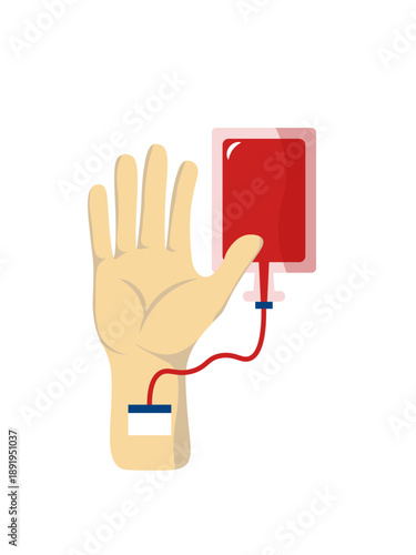 Vector Illustration of a Human Hand Connected to a Red Blood Donation Bag for Transfusion Concepts blood bag, blood donation, transfusion, iv bag, blood donor, human hand, arm, medical tubing