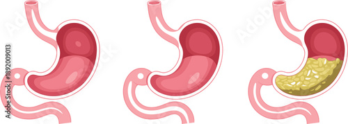 Human Stomach Anatomy Stages of Digestion with Food Particles Illustration Keywords: stomach, human, anatomy, digestive system