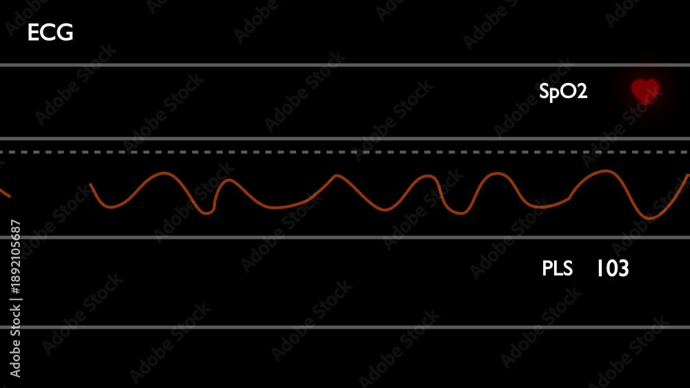Pulse display device used at the healthcare center SpO2 HUD ECG looping ...