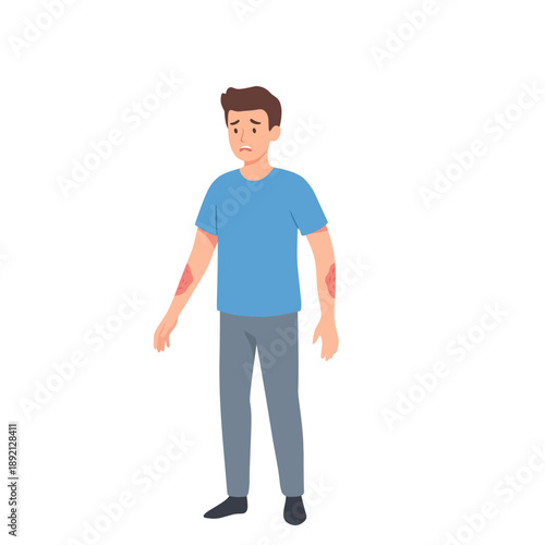Sad young man with skin rash on arms, showing irritation and discomfort. Flat vector illustration representing skin problem, allergy, dermatitis, or skin irritation concept on white background