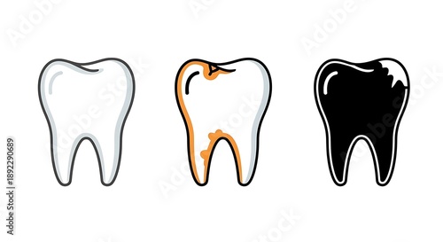 Three teeth showing decay and healthy stages in white and black colors dental tooth