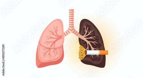 Diseased lung contrasted with healthy lung, with cigarette