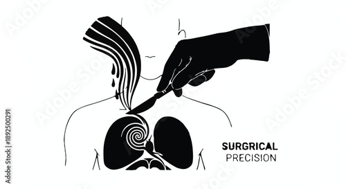 Medical illustration of surgical precision technique on human lungs