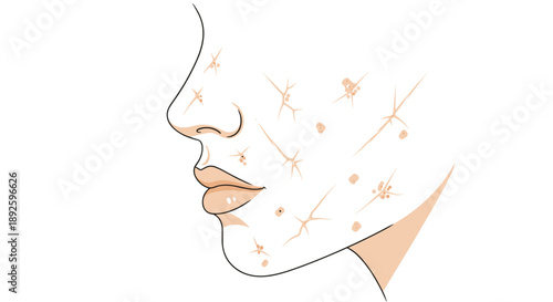 Line Art Profile of a Face Showing Skin Blemishes Acne and Scars Isolated on White