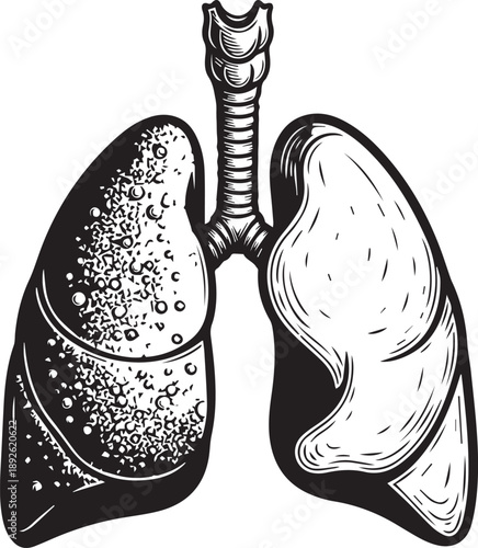 Illustration of healthy versus diseased lungs highlighting the impact of various respiratory conditions