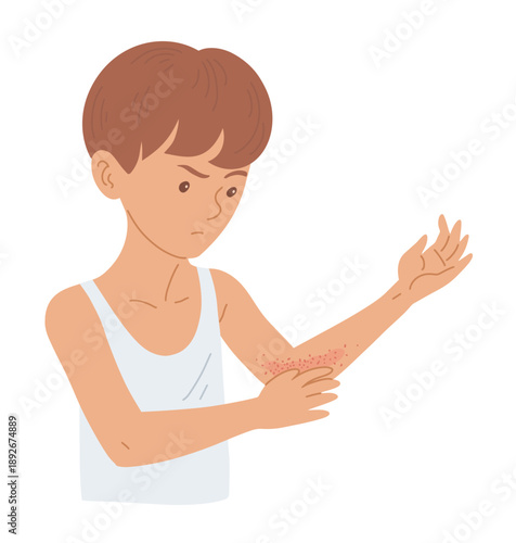 Boy scratching skin rash on elbow dermatitis concept