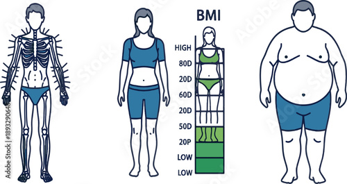 Print Medical Infographic Illustration of Human Anatomy and BMI Scale Featuring Body Composition Comparison and Skeletal Structure Analysis