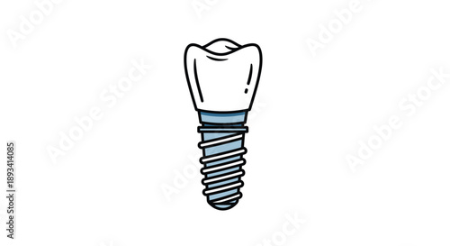 Detailed illustration of a dental implant with a white ceramic crown and a threaded metal post for dentistry procedures.