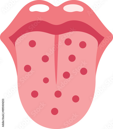 Vector illustration of tongue with red spots, oral health symptom, medical flat icon for disease diagnosis
