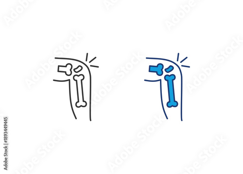 Osteoarthritis Icon Set Multiple Style Collection