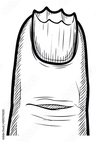 Detailed black and white sketch of a human toe showing a severely bitten and ragged toenail, useful for content related to health, hygiene, stress, or dermatology