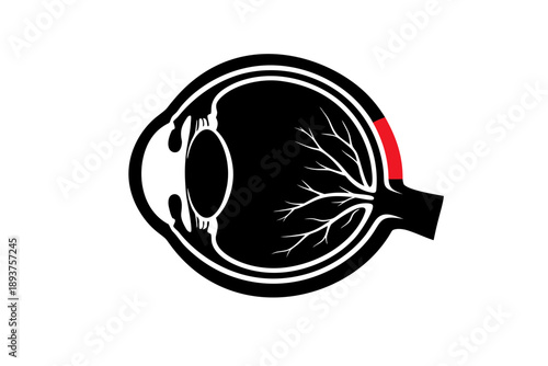 Scleritis Anatomical Cross Section Silhouette Vector Diagram