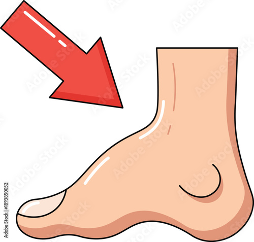 Ankle Pain and Foot Joint Problem Illustration