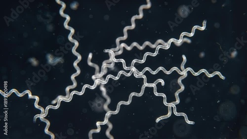 Lyme disease spirochetes floating in a liquid. Microscopic photo of a spirochete of Lyme disease bacteri. 