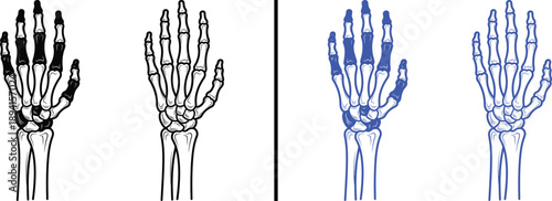 human hand skeleton anatomy icons isolated on white background, black and blue vector illustration of wrist and finger bones for medical and orthopedic concepts.