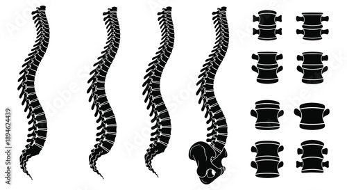 Anatomical illustration depicting various spinal curvatures and vertebral arrangements ideal for medical use on transparent background silhouette high quality professional detailed