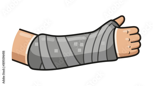 Cartoon arm in medical cast with bandages and thumbs up gesture