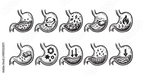 Detailed black and white illustration depicts the stages of the digestive process within the human stomach. This medical diagram showcases the breakdown and absorption of food.