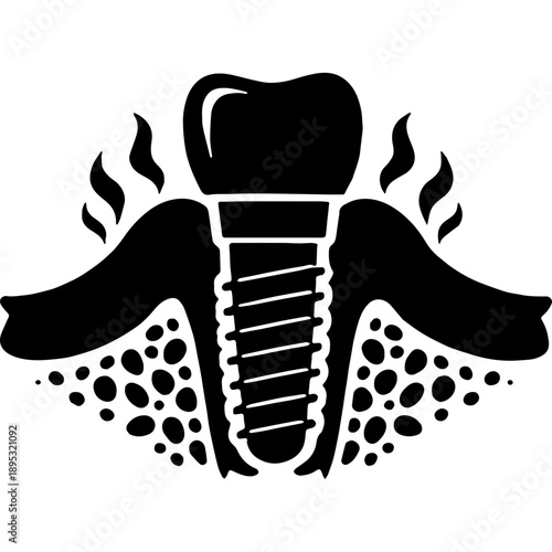 Black Silhouette Vector of Peri-Implant Mucositis Anatomy
