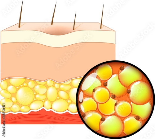 Fat tissue under skin. Close-up of adipocytes. Fat cells.