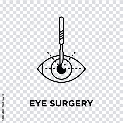 Vector illustration medical illustration of eye surgery with a surgical instrument inserted
