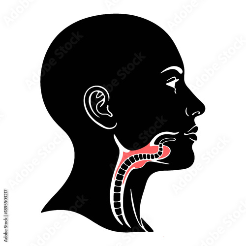 Esophageal Mucositis Throat Pain Black Silhouette Diagram