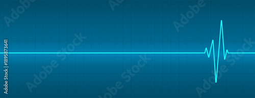 glowing medic cardio ecg graph background