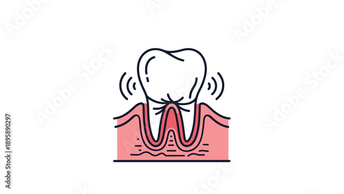 Anatomical diagram of a white tooth shaking and vibrating within inflamed red gums indicating dental pain or gum disease.