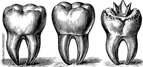 Vintage 19th century botanical engraving of tooth enamel structure