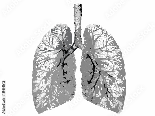 Anatomical illustration depicting human lungs with branching bronchial tree structure