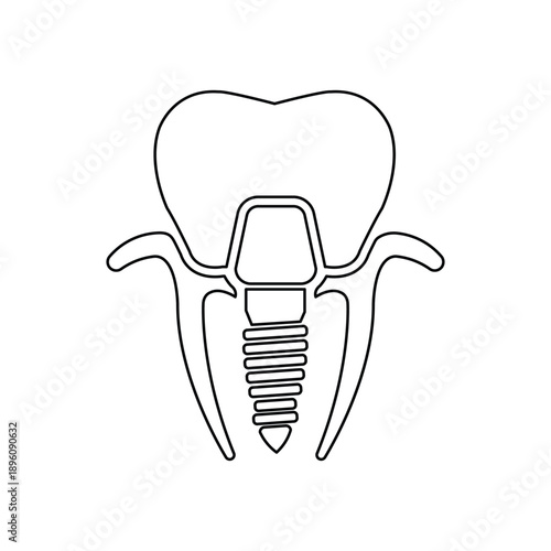 Dental Implant Line Icon Tooth Restoration Vector Illustration for Dentistry