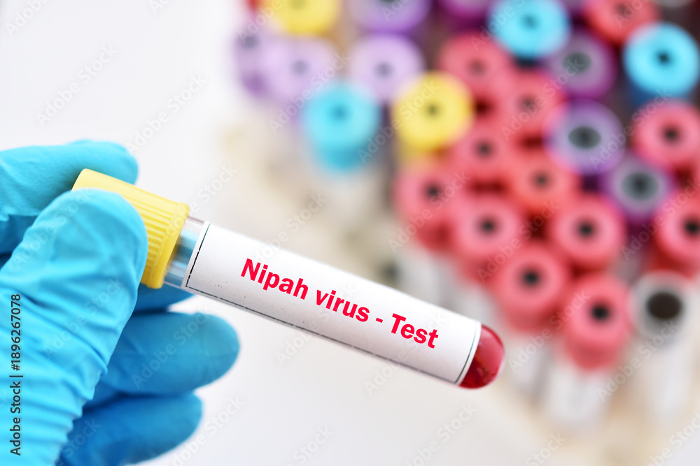 Obraz premium Blood sample tube for Nipah virus test